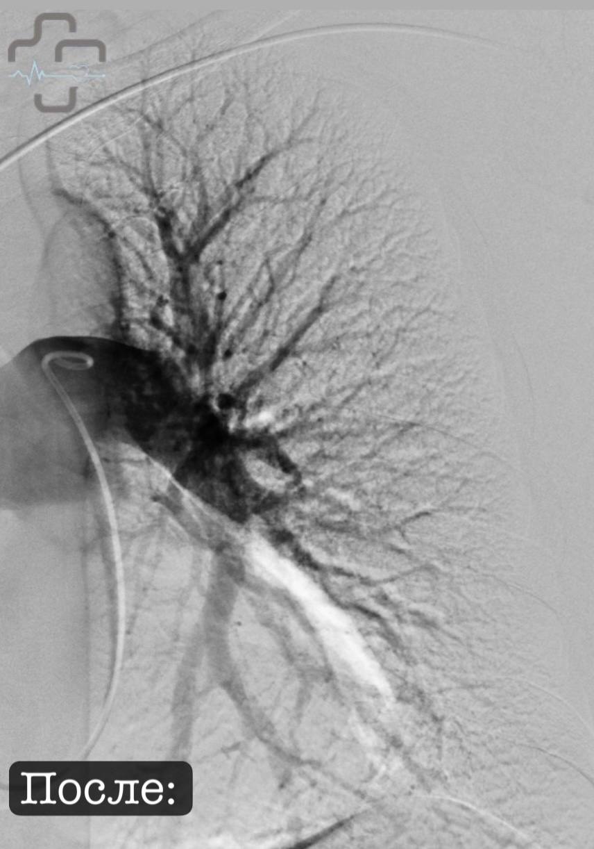 В Орске врачи спасли пациентку из Оренбурга с тяжелым диагнозом В Орске врачи спасли пациентку из Оренбурга с тяжелым диагнозом