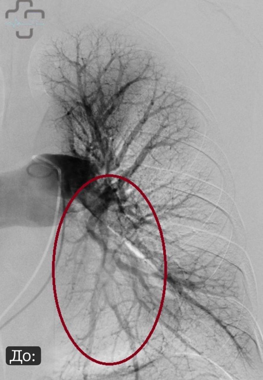 В Орске врачи спасли пациентку из Оренбурга с тяжелым диагнозом В Орске врачи спасли пациентку из Оренбурга с тяжелым диагнозом
