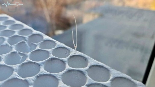 Задыхающегося из-за рыбьей кости в горле пациента спасли в больнице Орска