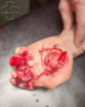 � ���������� ��������� ������� ����� ��-�� �������