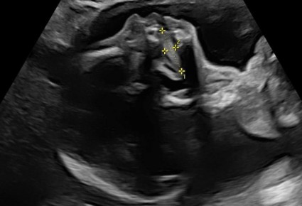 ����� ���������� ��������� ��� ������� ��������� �������� � �����