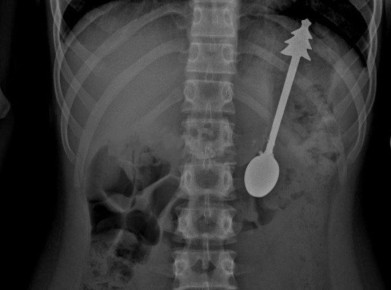 ������� �������� ��������� 14-������������� ����� � ���������