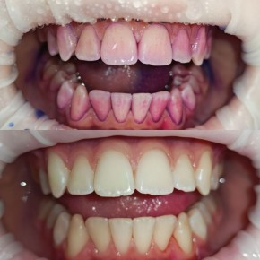 ��� ���������������� ����������� ������� ������ �������� � ������ � �����