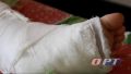� ������������� ���������� ��� ������� 400 ����� ������ �� ������� ������