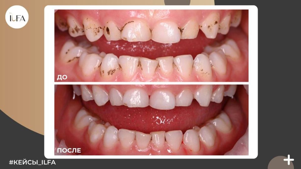 Налёт Пристли у детей: спокойное объяснение и путь к исчезновению